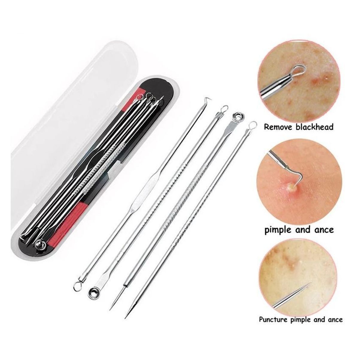 GENERICO - Kit para retirar acné en acero inoxidable grado quirúrgico color plata