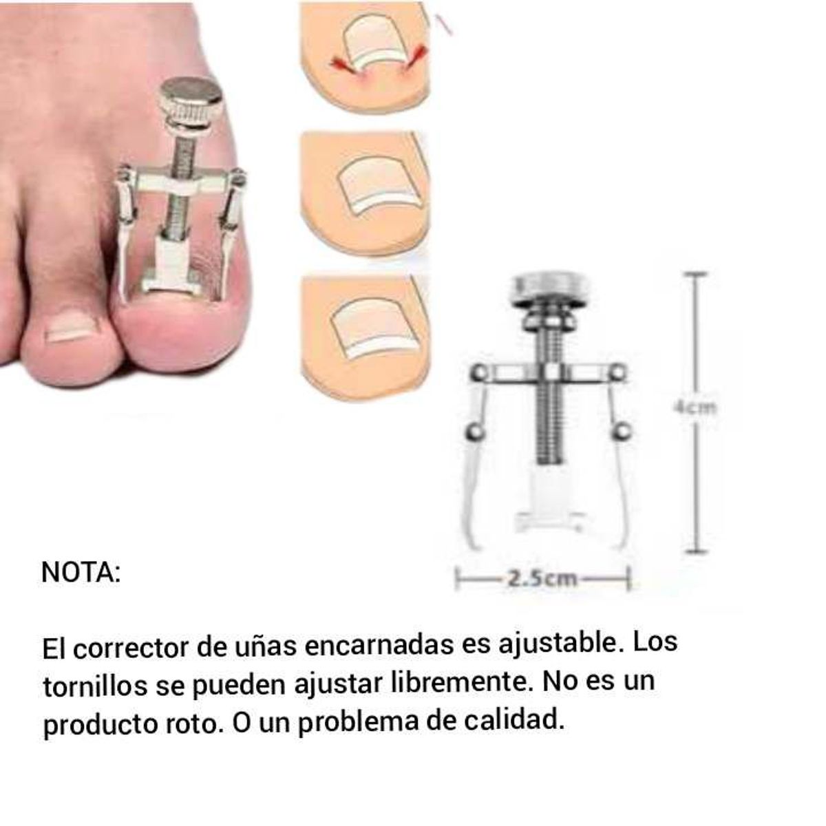 GENERICO - kit pedicura uñas gruesas encarnadas kit cortauñas
