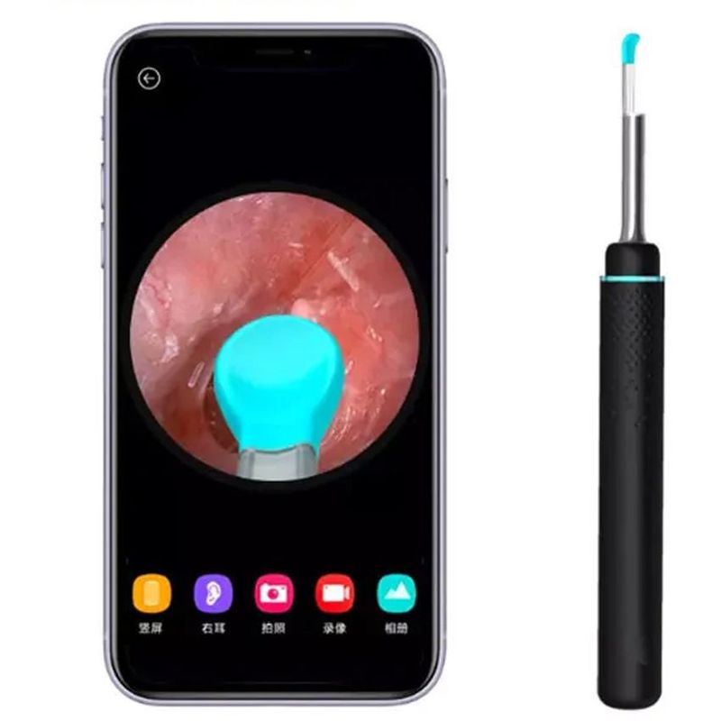 GENERICO - Limpiador Oido Endoscopio Otoscopio FK23B-34 Usb Camara Recargable