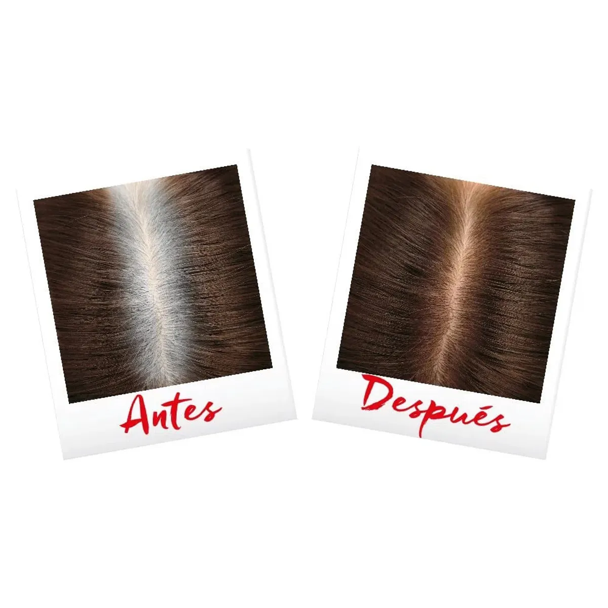 LOREAL PARIS - Spray Retocador De Raíz L'oréal Paris Magic Retouch Castaño