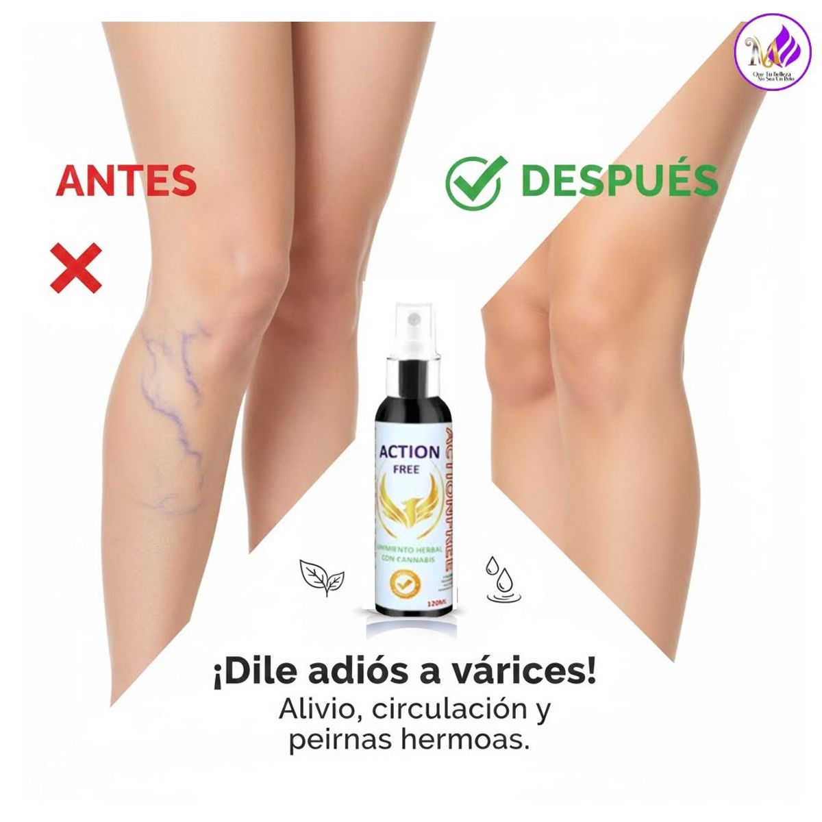 GENERICO - Action Free Gel para Piernas Cansadas Várices y Arañitas - Alivio Rápido