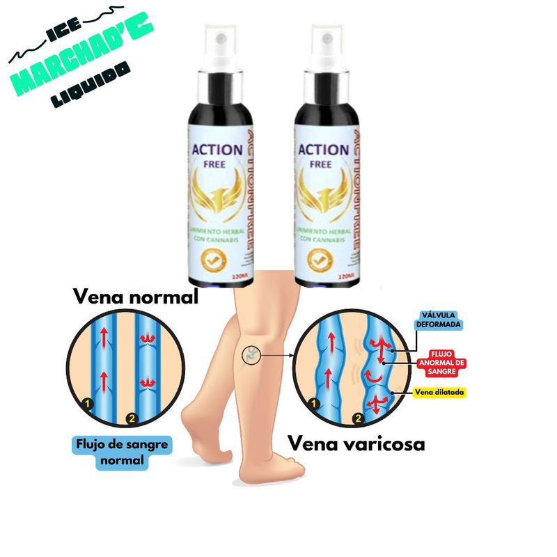 GENERICO - Elimina varices y arañitas  éxito del 98%