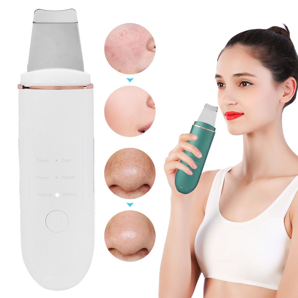 CARER SPARK - Limpiador Espátula Facial Ultrasonidos Eliminador De Puntos Negros