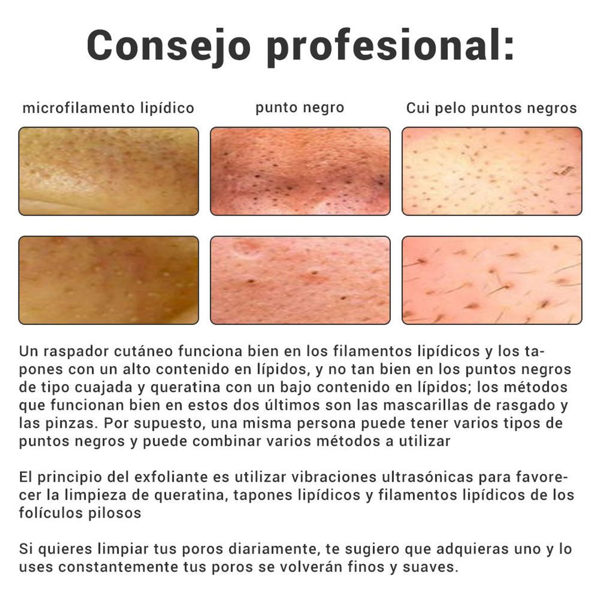 CARER SPARK - Limpiador Espátula Facial Ultrasonidos Eliminador De Puntos Negros