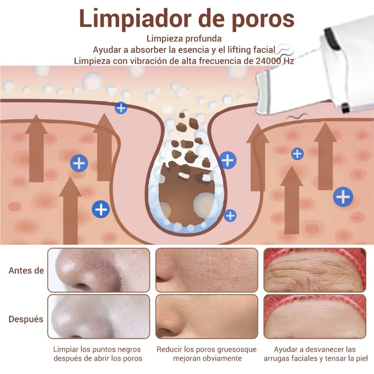 CARER SPARK - Extractor Peeling Limpiador De Poros Con Vibración Skin Scrubber