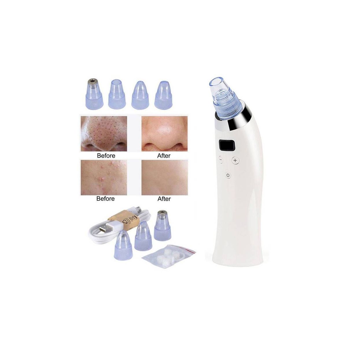 GENERICO - Removedor De Puntos Negros Eficaz Para Eliminar Impurezas