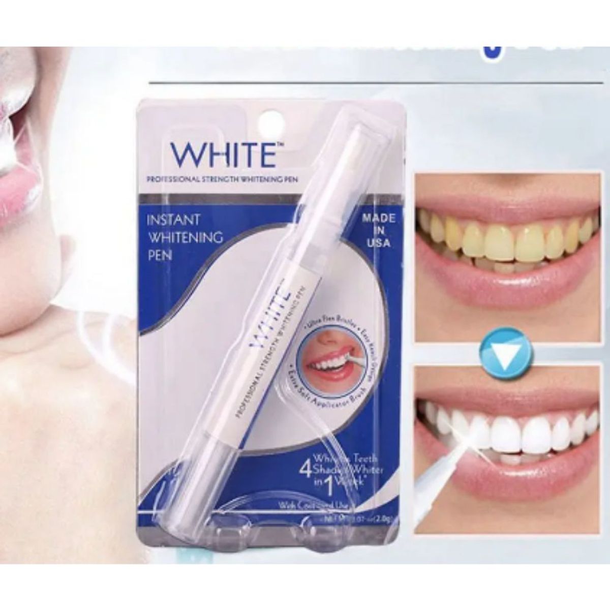 GENERICO - Blanqueamiento Dental Lápiz