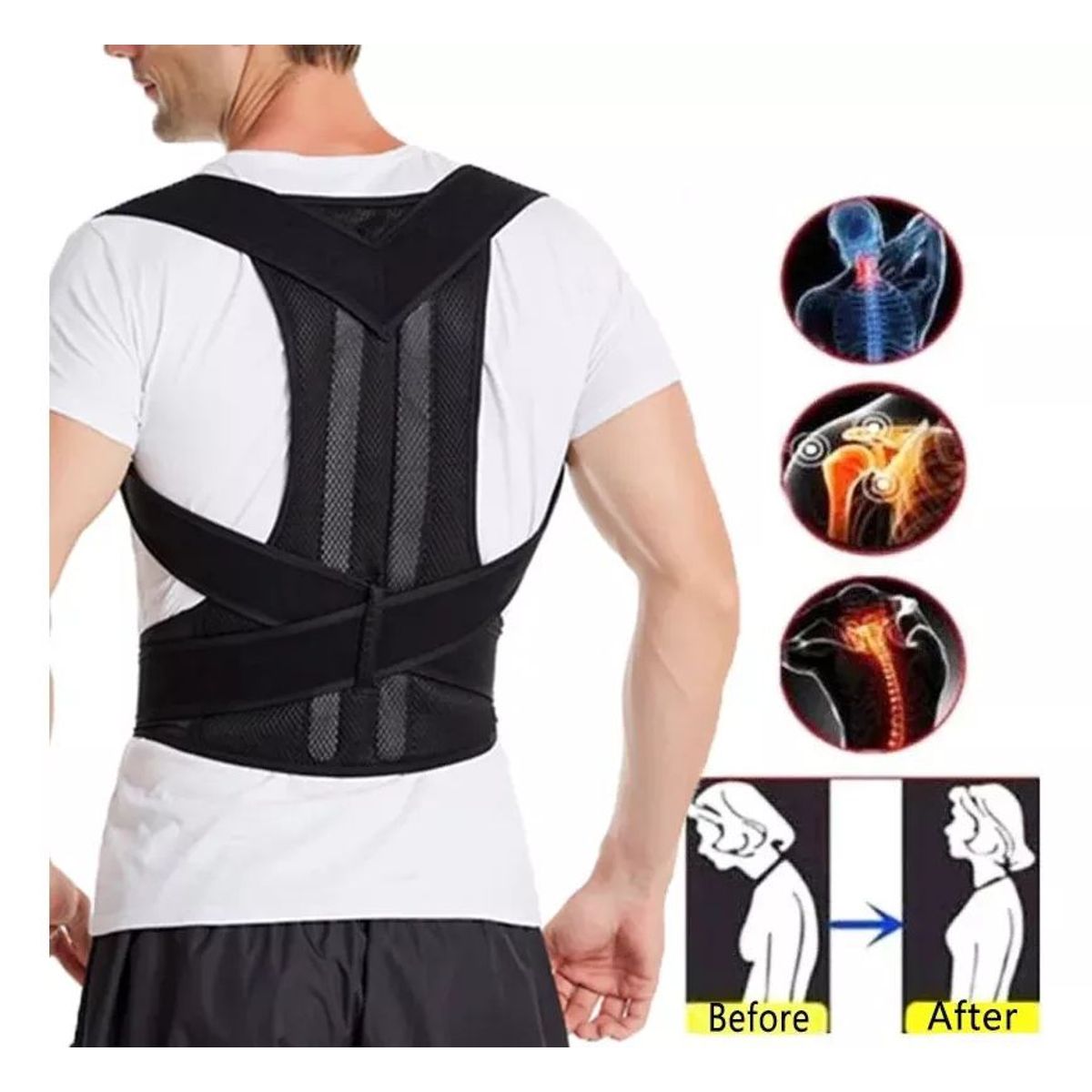 GENERICO - Faja Correctora De Postura Escoliosis Espalda Barras