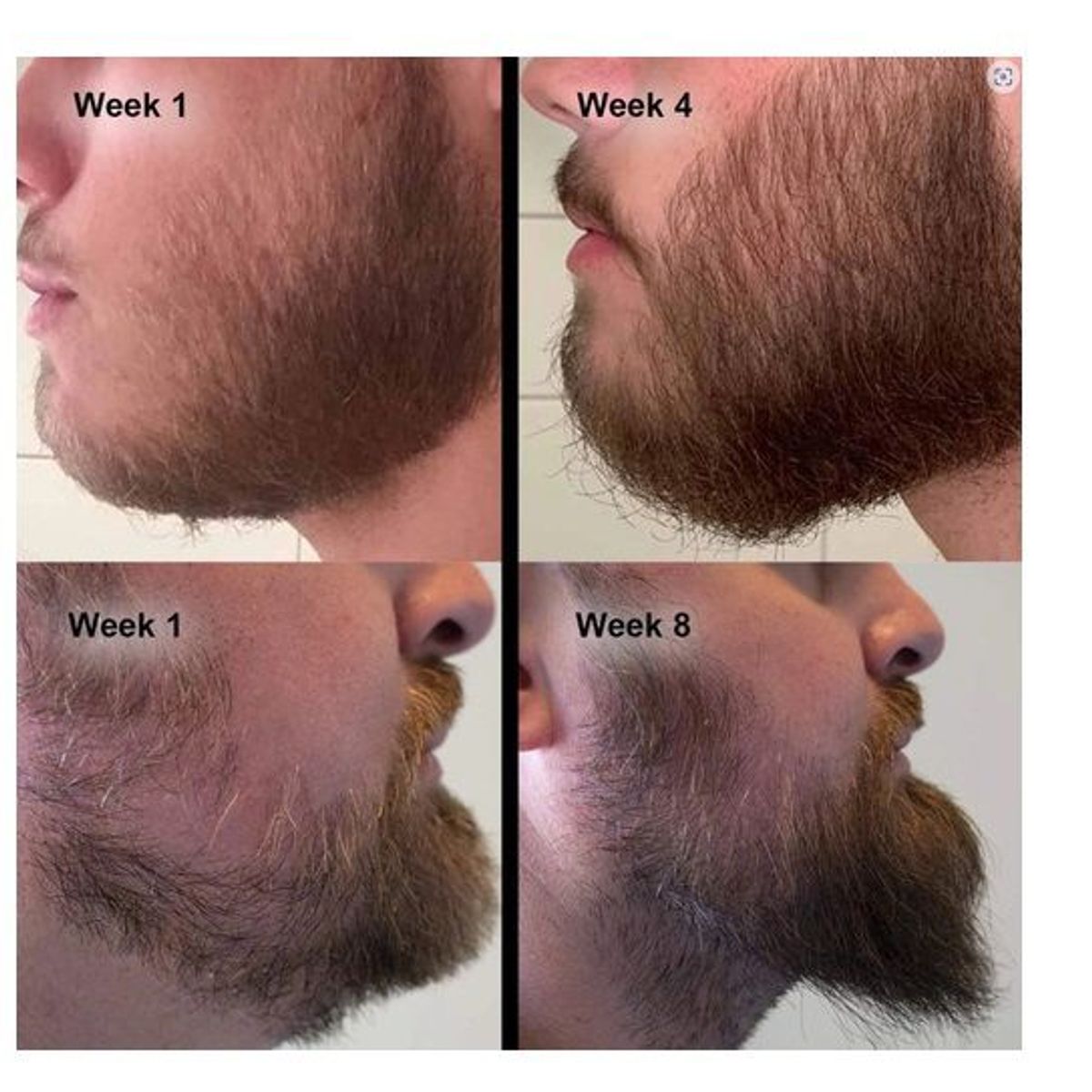 GENERICO - Derma Roller Barba 05mm Hombre