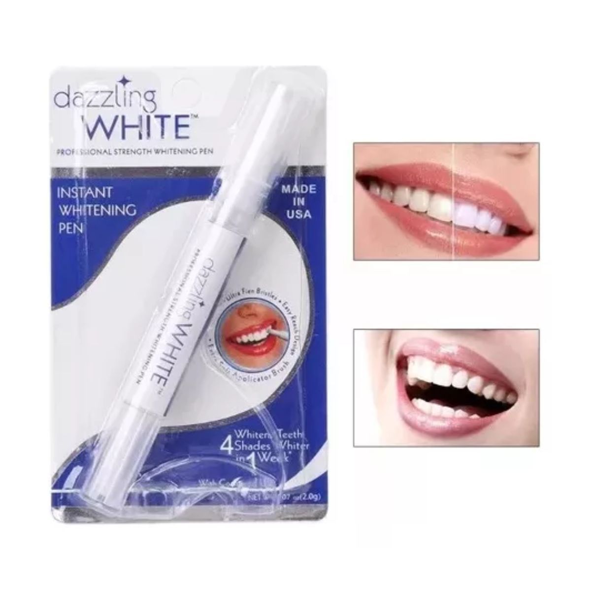 AFM - Lápiz Blanqueador Dental White
