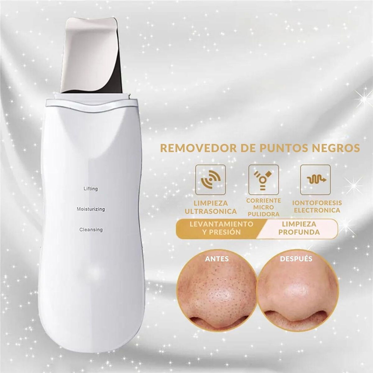 GENERICO - Limpiador De Poros ultrasónica Facial Removedor De Puntos Negros