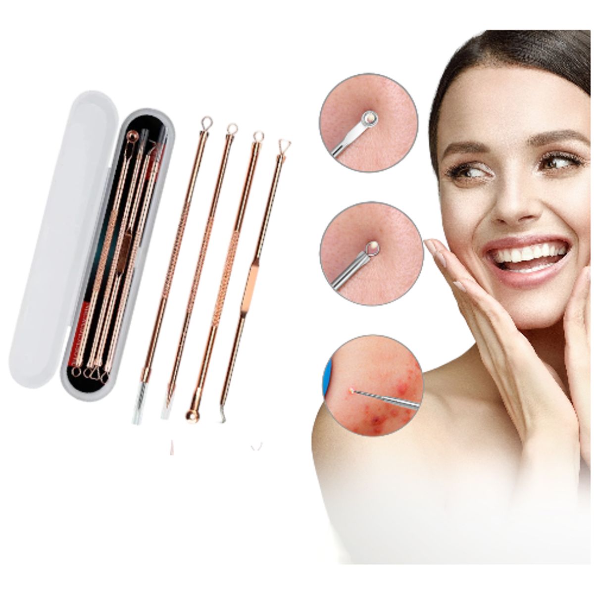 GENERICO - Kit X4 Extractor Removedor Espinillas Puntos Negros Acné