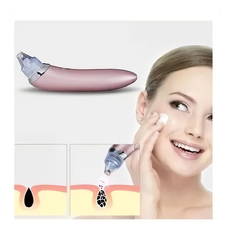 GENERICO - Limpiador Facial Succión Puntos Negros Poros Barros