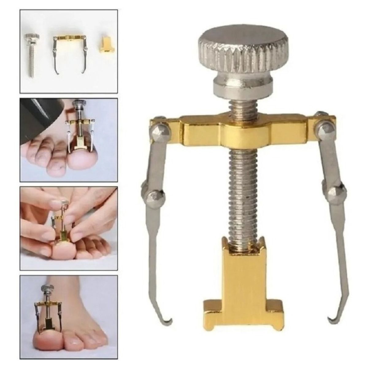 GENERICO - Uñero Profesional Corrector De Uñas Encarnadas Enterradas