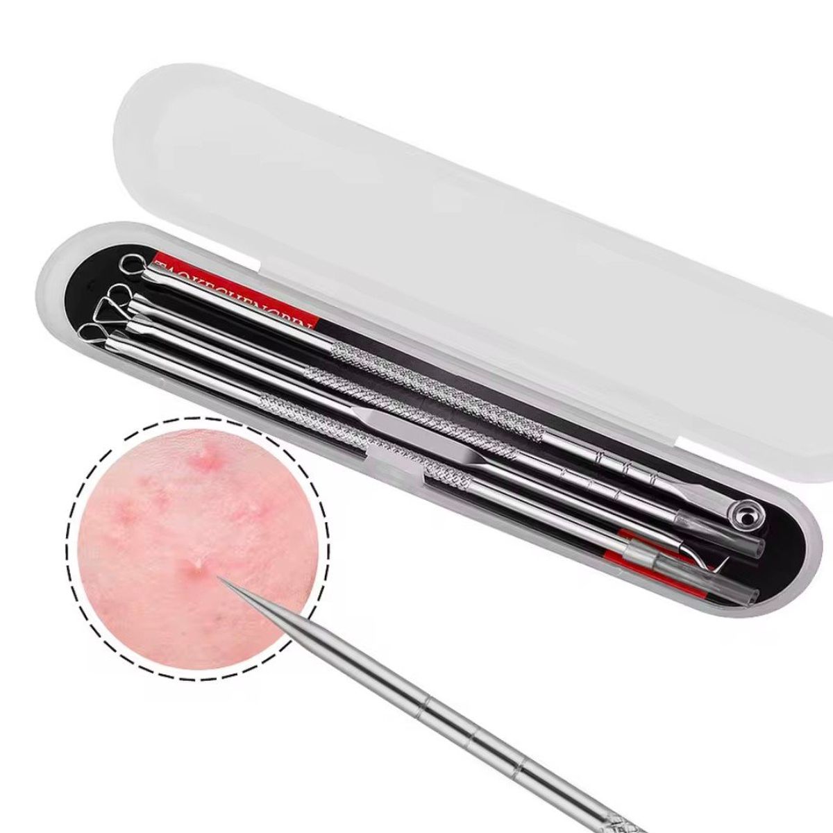 GENERICO - Kit retirar espinillas acne puntos negros limpieza facial