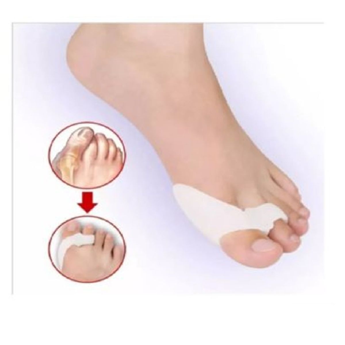 GENERICO - Corrector De Juanetes Separador De Dedos Silicona