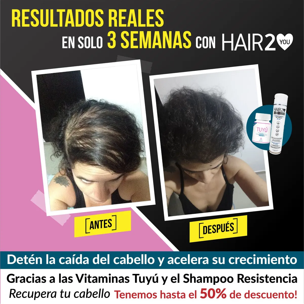 HAIR2YOU - Rutina contra la caída del cabello x 3 Vitaminas y 9 productos más!