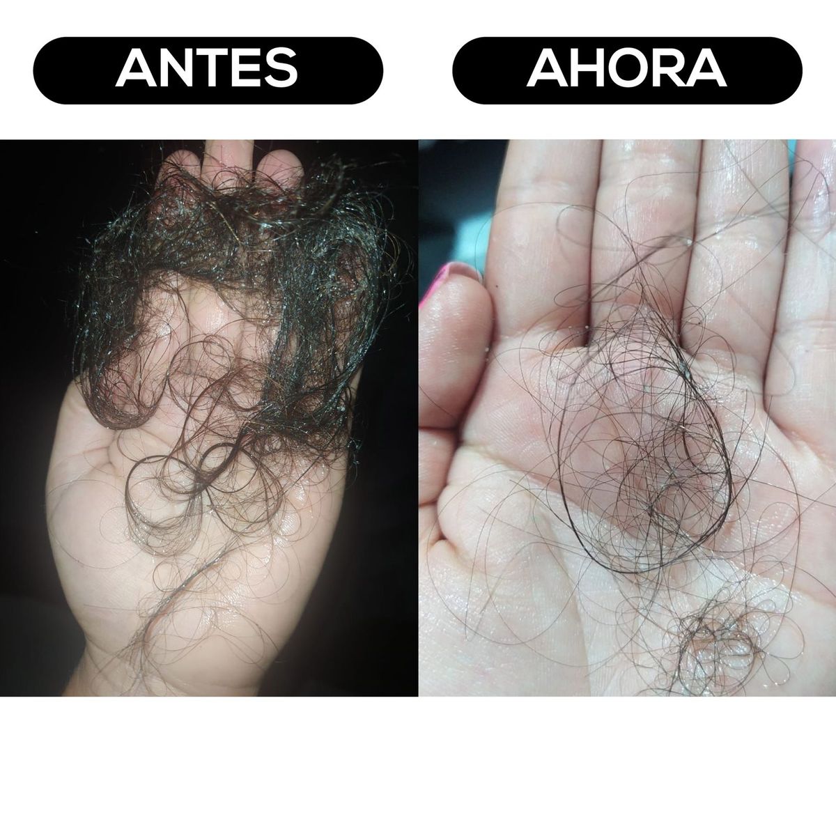 HAIR2YOU - Tratamiento contra la caída del cabello Completo x 7 Productos