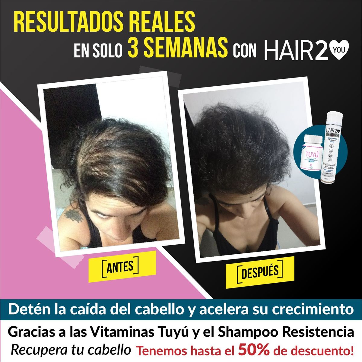 HAIR2YOU - Rutina contra la caída del cabello x 2 Vitaminas + 2 Loción capilar + 2 shots
