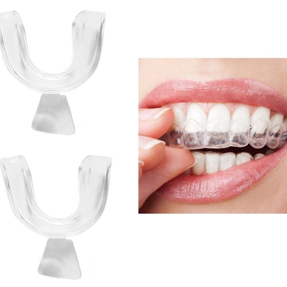 GENERICO - Placa Dental Bruxismo X 2 Ronquido Blanqueamiento Protector