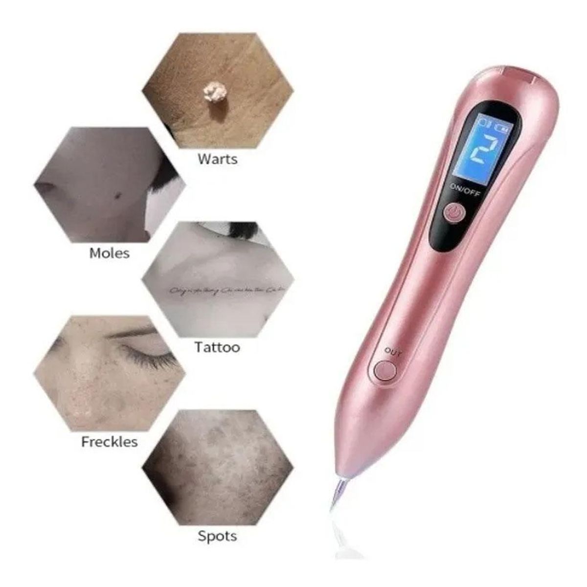 SKY - Quita Verrugas Pecas De Plasma Láser