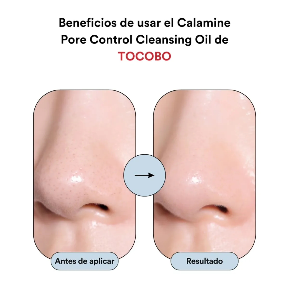 TOCOBO - Aceite desmaquillante Calamine Pore Control Cleansing Oil de TOCOBO