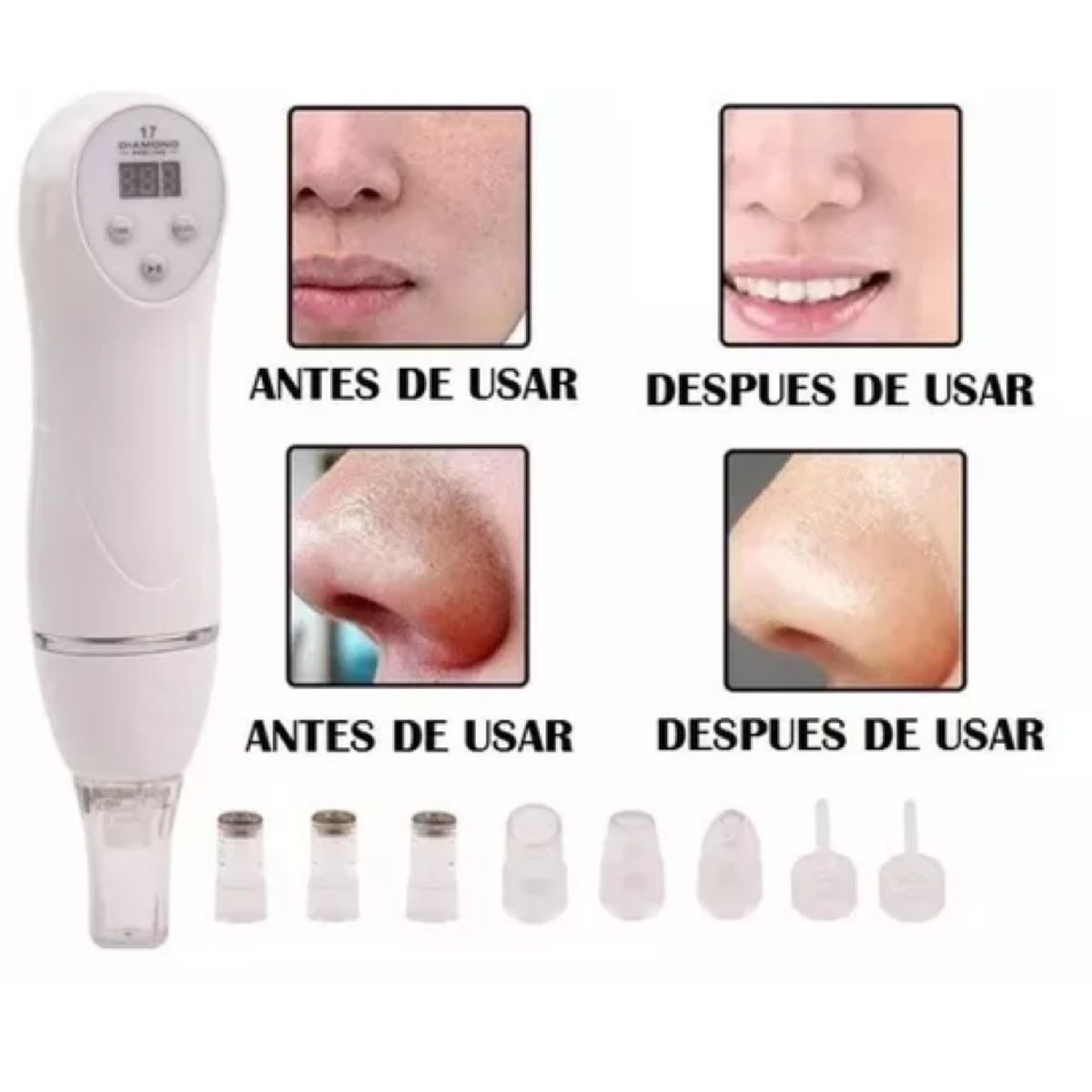 GENERICO - DIAMOND PEELING MICRODERMOABRASION FACIAL CON ESTUCHE Y BOQUILLAS