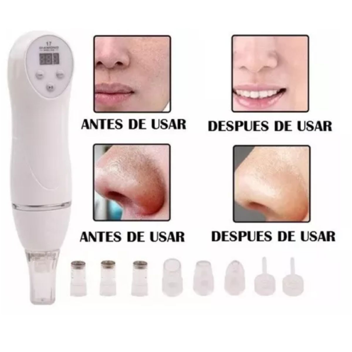 GENERICO - DIAMOND PEELING MICRODERMOABRASION FACIAL CON ESTUCHE Y BOQUILLAS