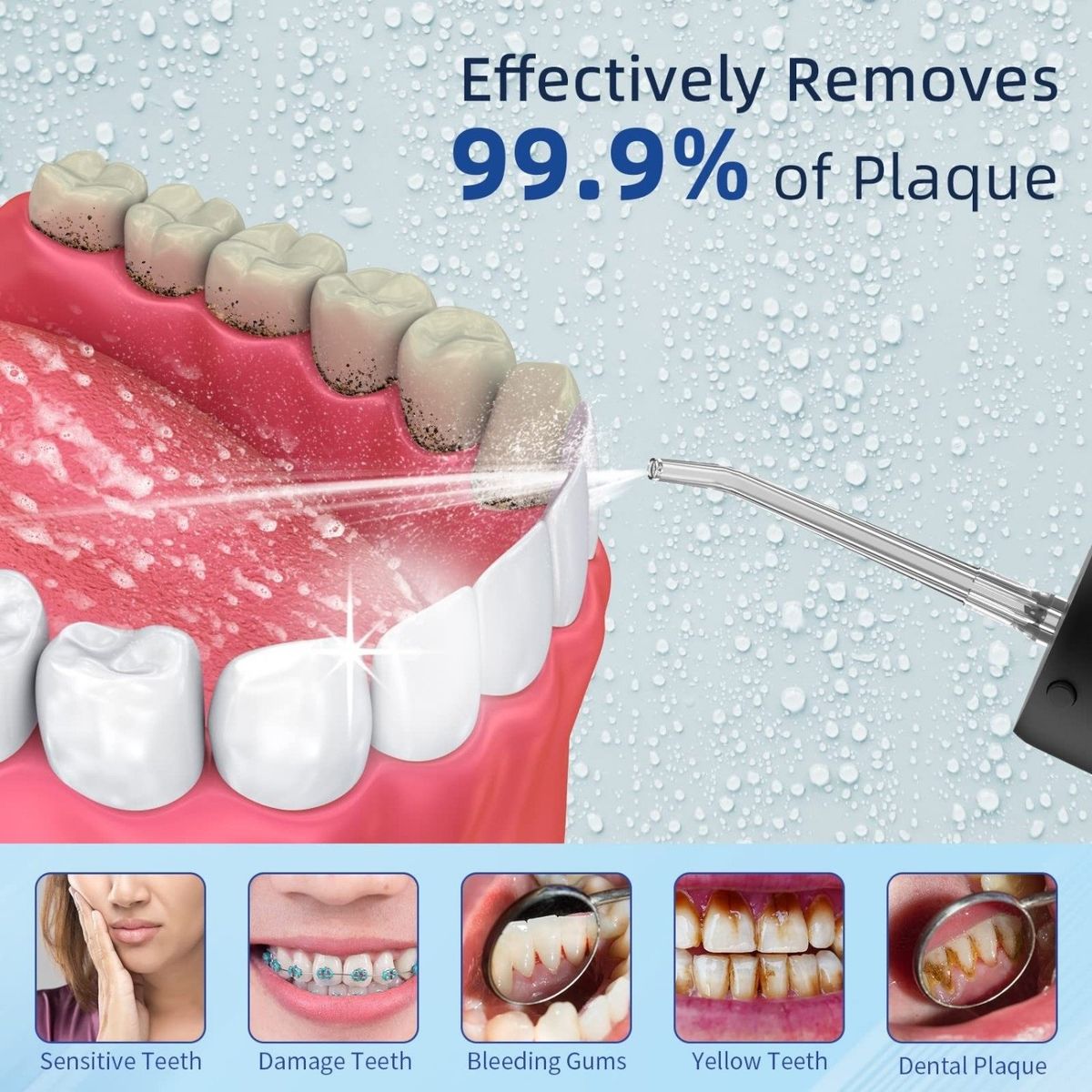 ALTA - Irrigador Bucal De Alta Presion Para Dientes Sanos