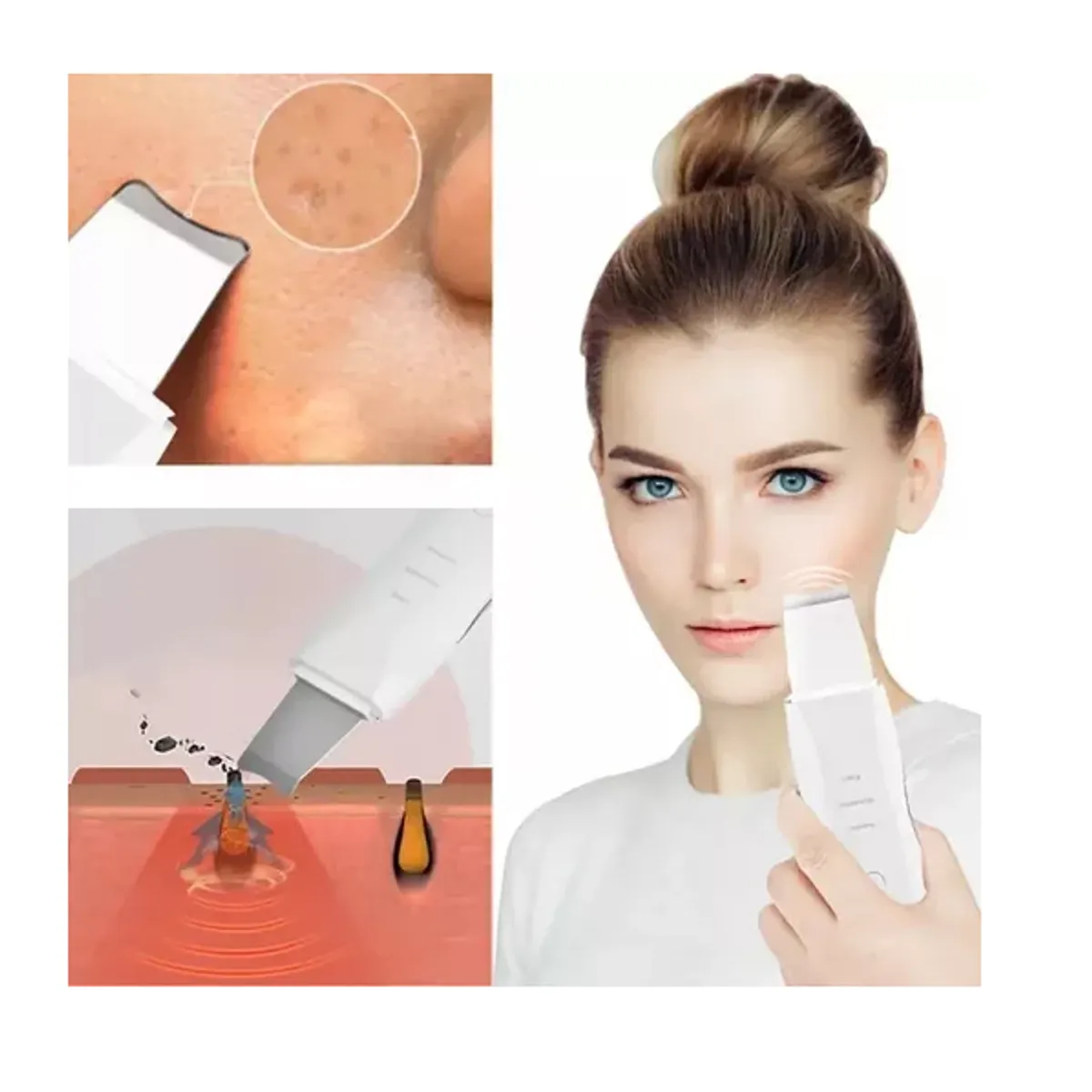 GENERICO - Paleta Ultrasónica Facial Espátula Limpiador Exfoliante Piel