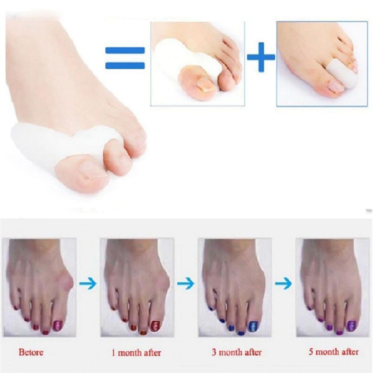 SKY - CORRECTOR DE JUANETE DE SILICONA