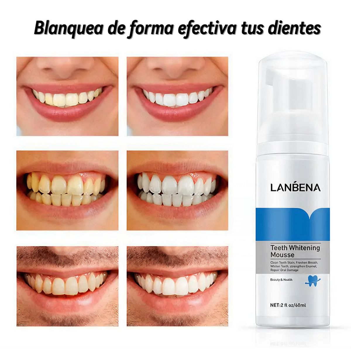 GENERICO - Blanqueador Dental En Espuma