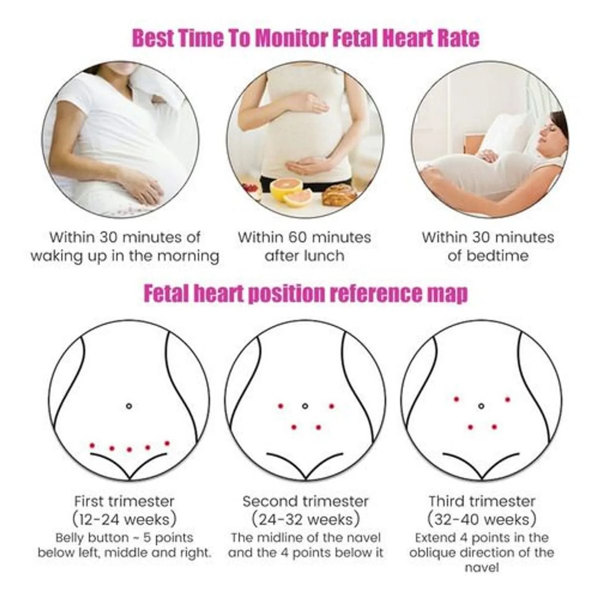 GENERICO - Doppler Fetal Ultrasonido Monitor De Latidos Bebe Prenatal