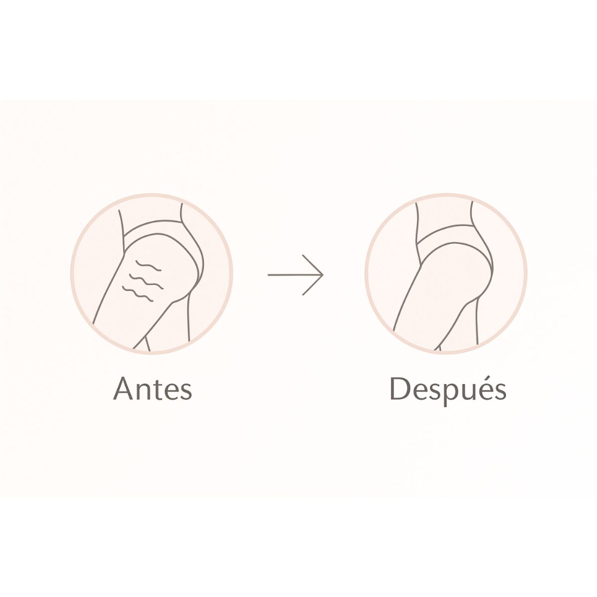 GENERICO - Reafirmante Corporal Portátil Radiofrecuencia Anticelulitis 3 Niveles Ajustables