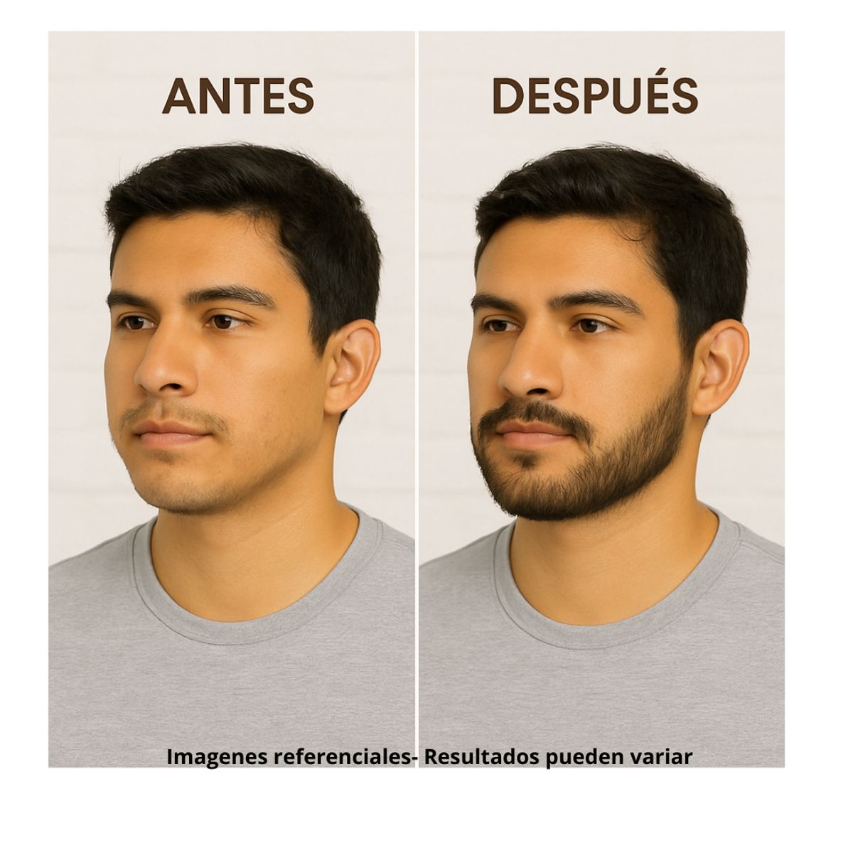 SIGNATURE - Kit Barba Minoxidil Kirkland + Dermaroller Original  Crecimiento Real