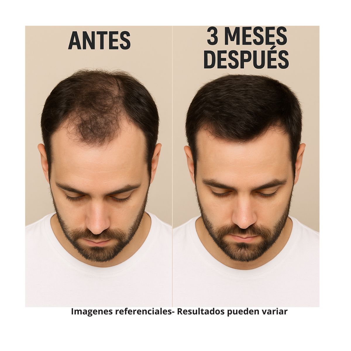 KARICIA - Capixyl 5% Karicia Hombre  Crecimiento Barba y Cabello Piel Sensible