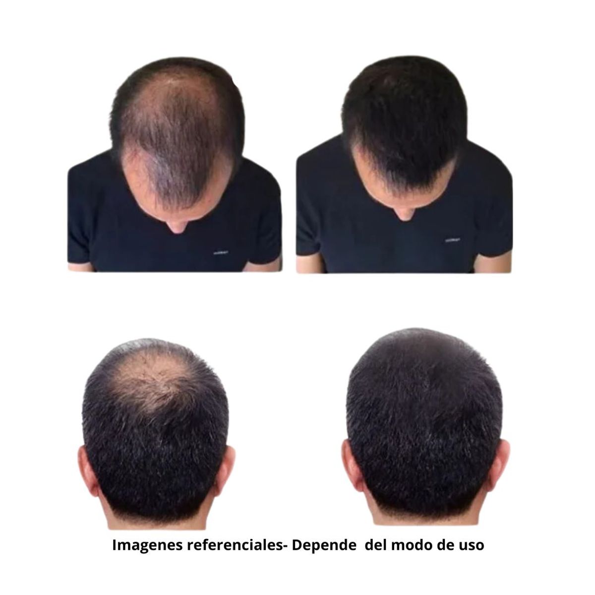 TOPPIK - Toppik Kit Fibras Capilares Color Castaño Oscuro + Aplicador Cobertura Rápida