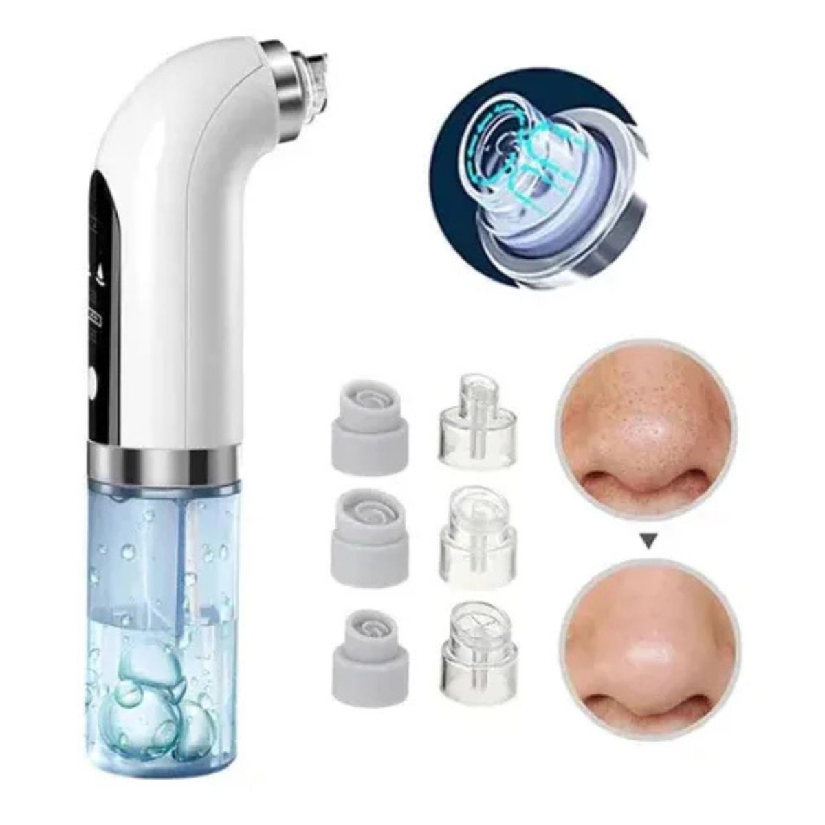 GENERICO - Extractor De Espinillas Puntos Negros Limpiador De Acne