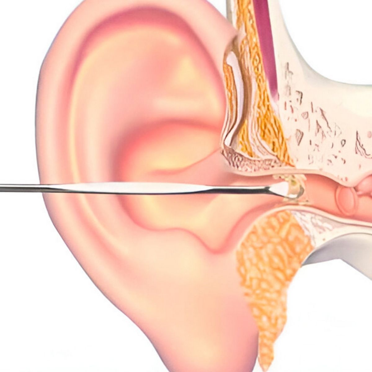 DAYOSHOP - Set Kit Limpieza Higiene Cera Oídos Orejas Reutilizable