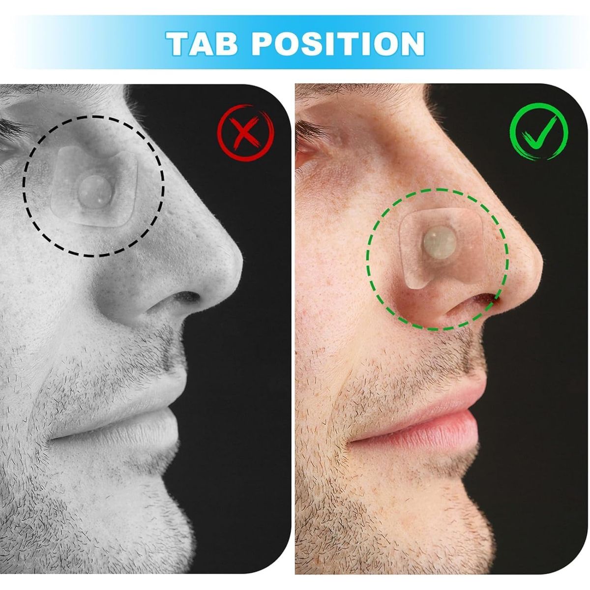 GENERICO - Dilatador Nasal Magnetico