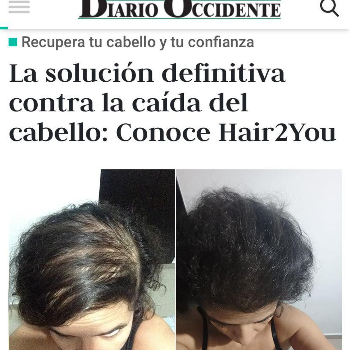 HAIR2YOU - Pague 2 lleve 3 Shot de crecimiento acelerado capilar