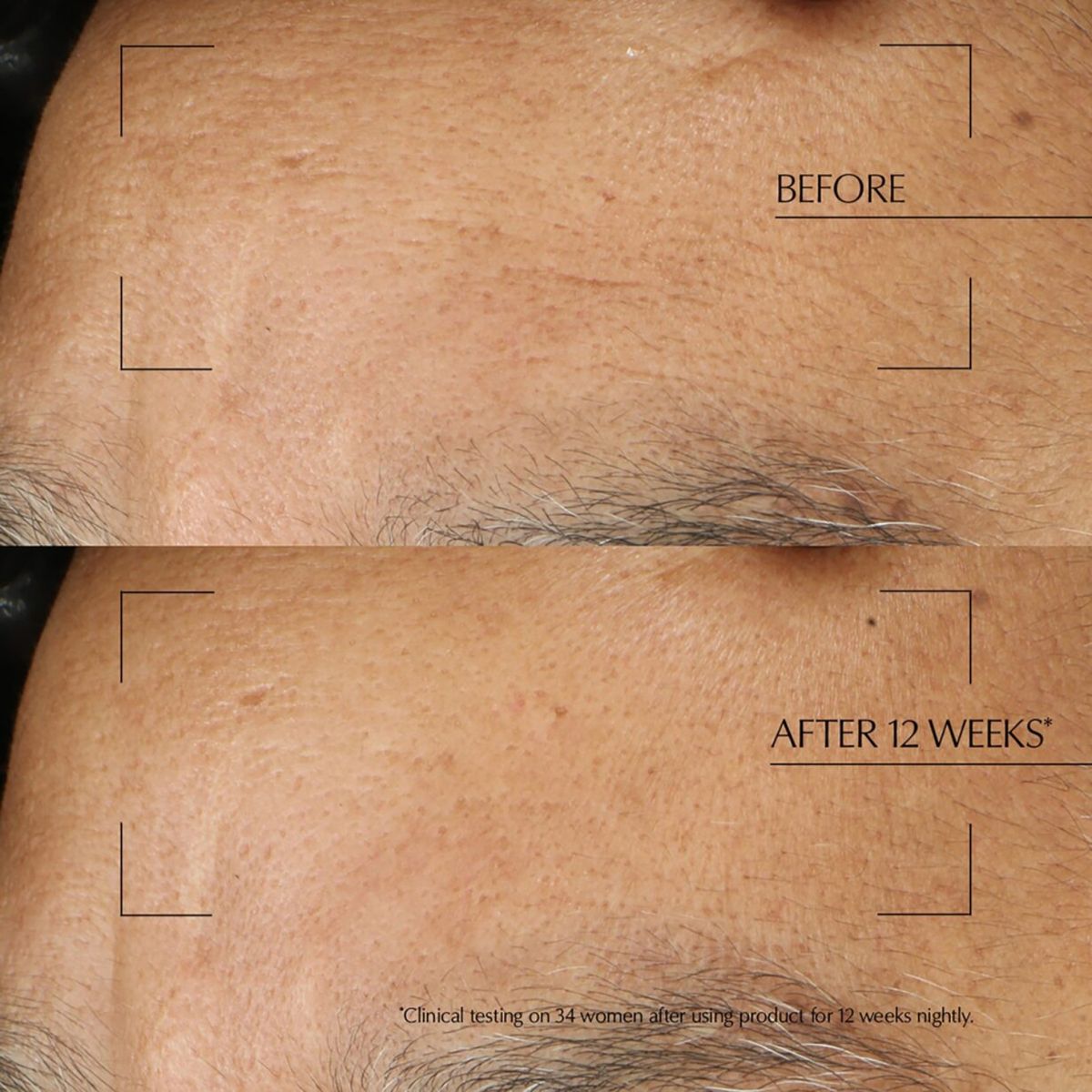 ESTEE LAUDER - Tónico facial Tratamiento Nocturno Advanced Night Repair Estee Lauder para Todo tipo de piel 65 ml