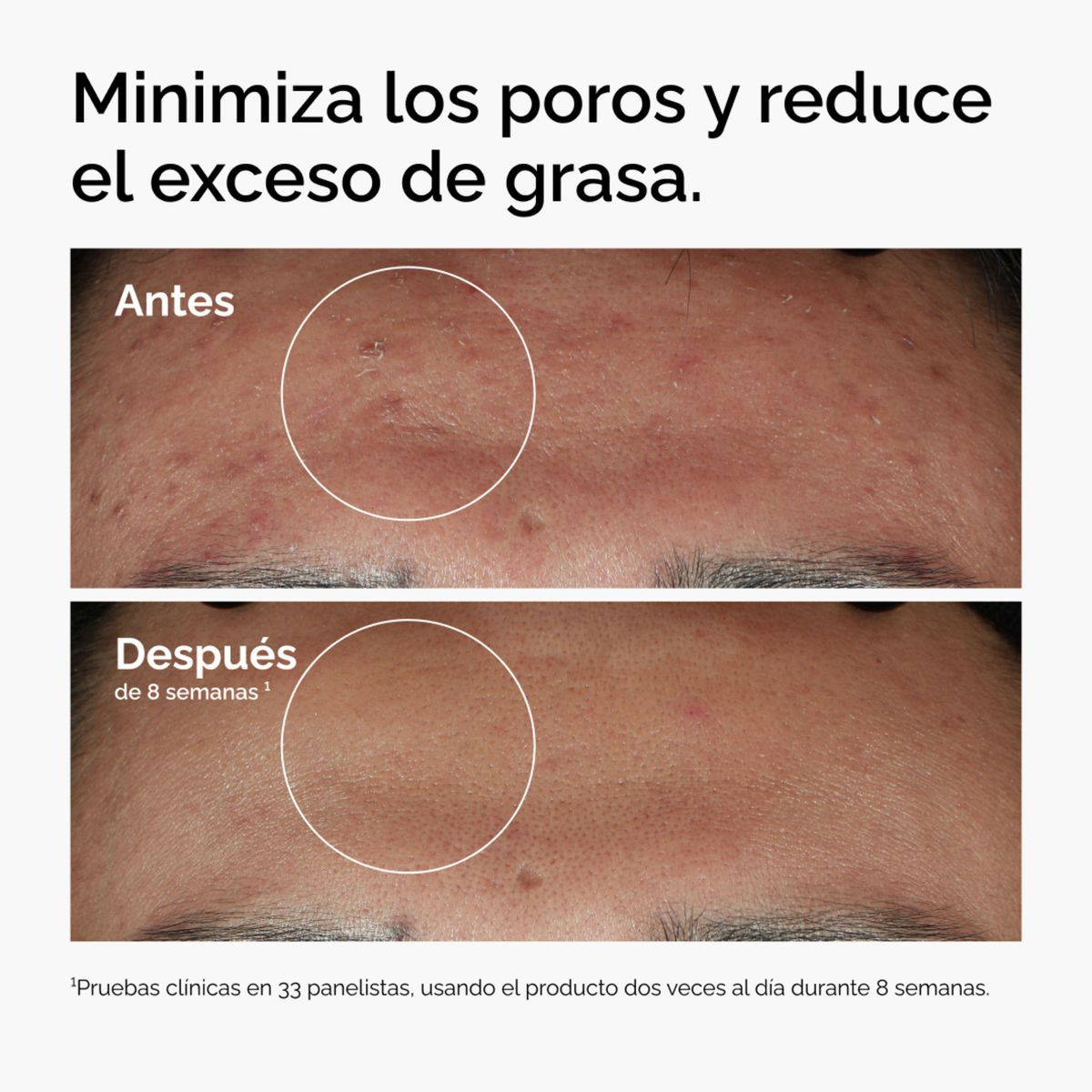 THE ORDINARY - Sérum Niacinamida 10% + Zinc 1% - The Ordinary para Todo tipo de piel 30 ml