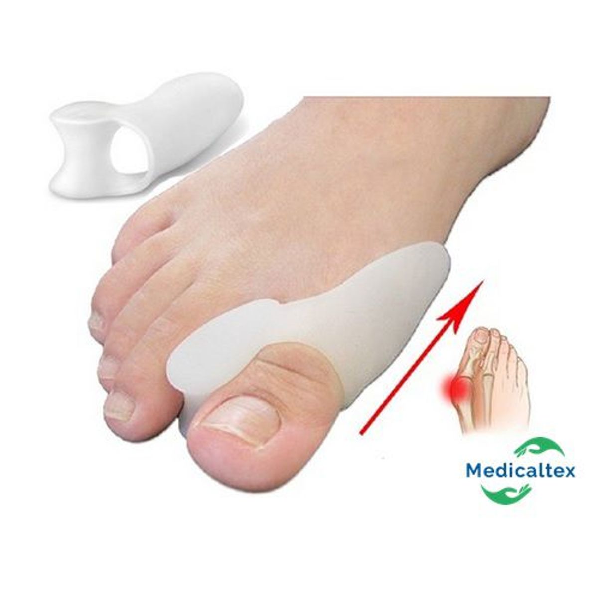 OEM - Gel Corrector De Silicona De Juanetes Con Separador De Dedos