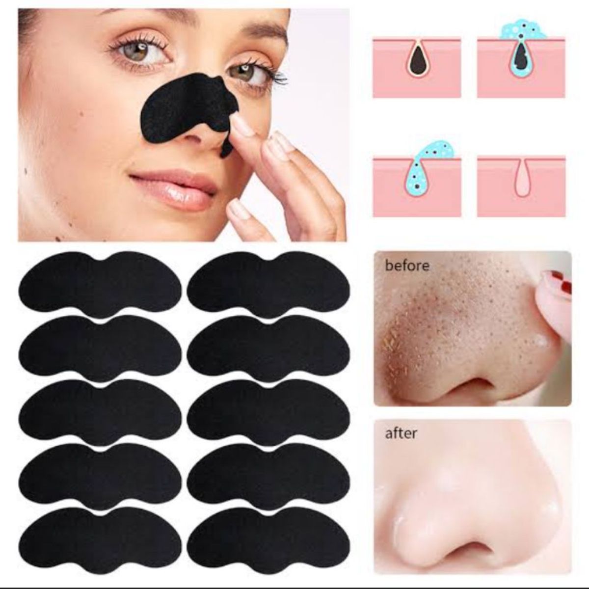 GENERICO - Mascarilla Exfoliadora para Eliminar Puntos NegrosEspinillas