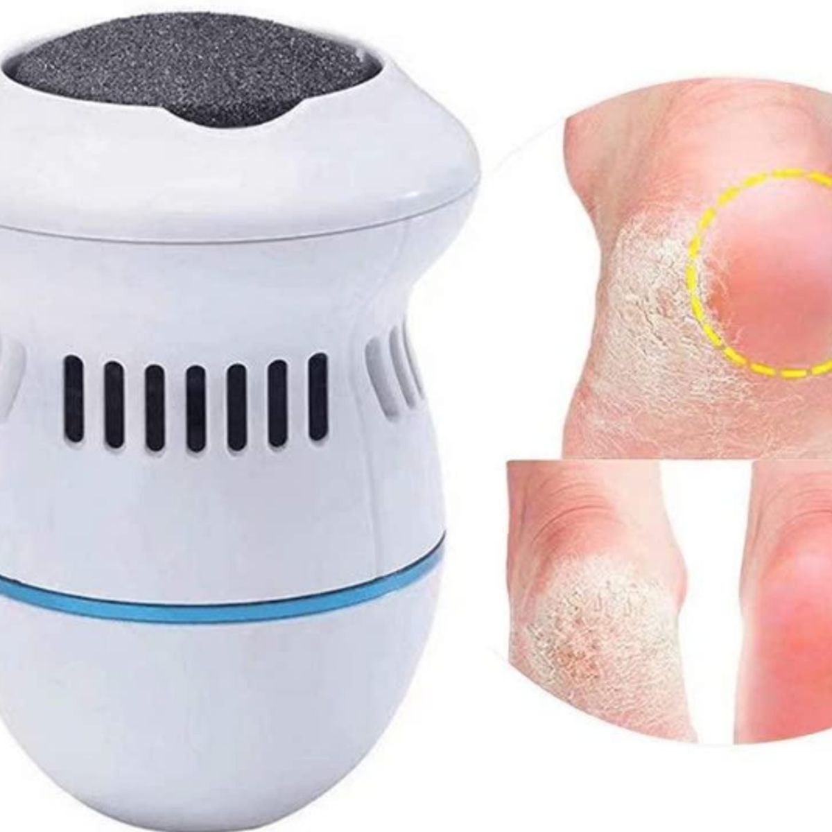 GENERICO - Removedor de Callos e Impurezas para Pies