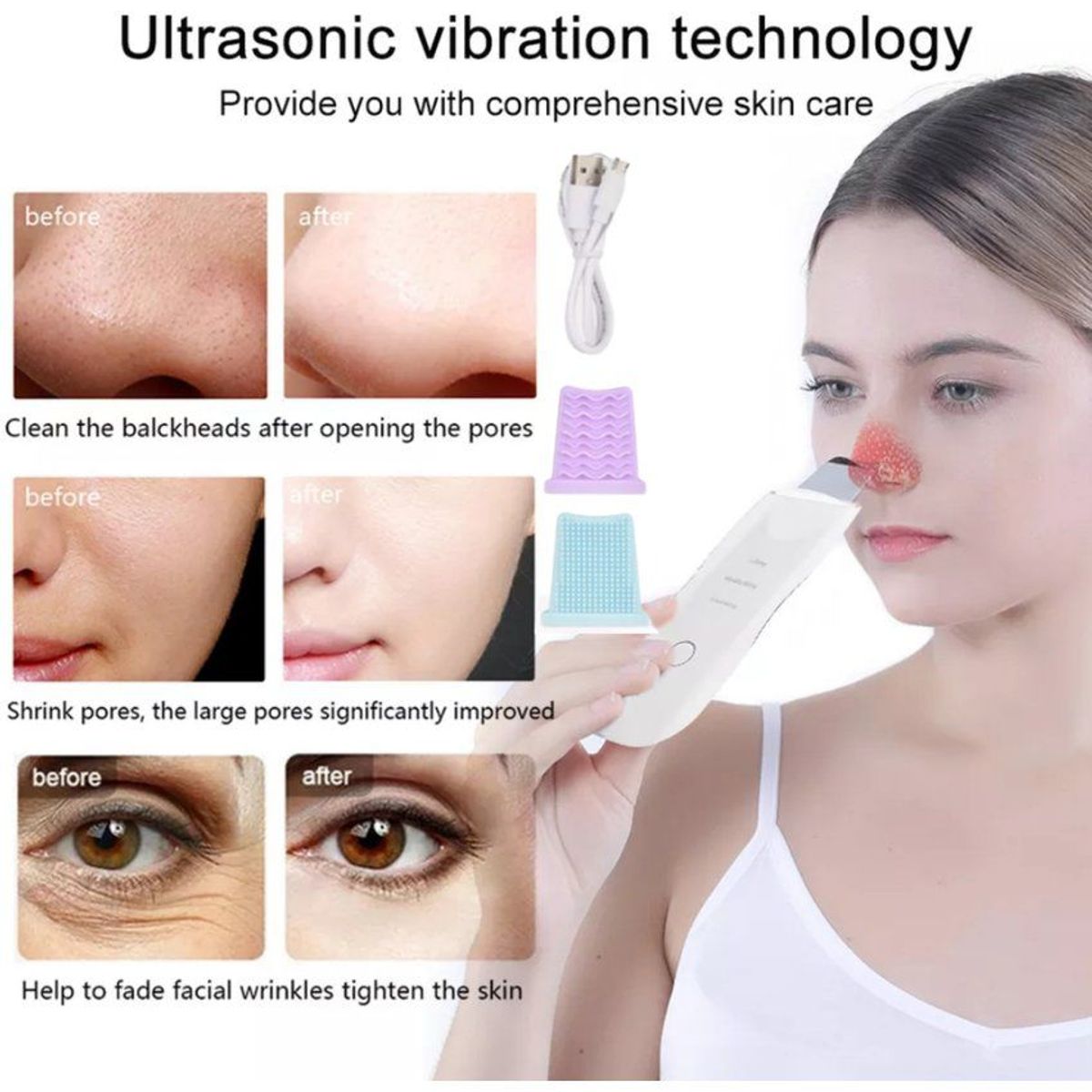 OEM - Limpiador Facial Espátula Quita Espinillas ULTRASONICO