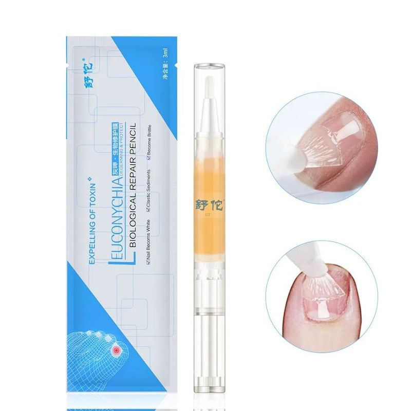 GENERICO - Lápiz Reparador de Uñas de los Pies y Manos - LEUCONYCHIA