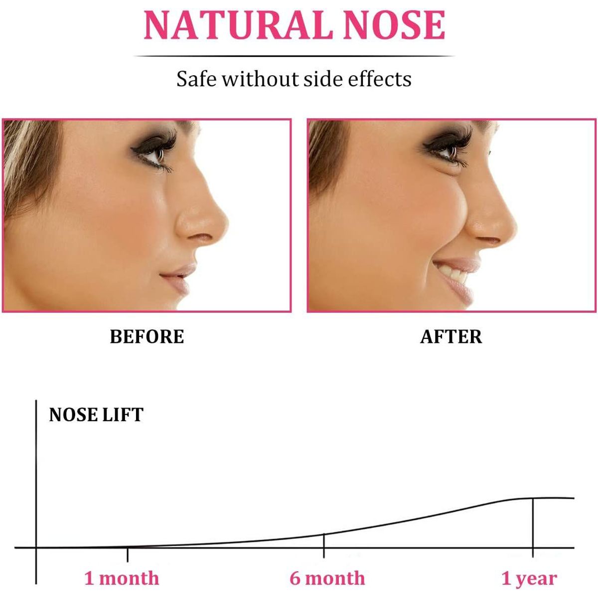 GENERICO - Corrector Respinga Nariz Afina Endereza Reduce Acomoda