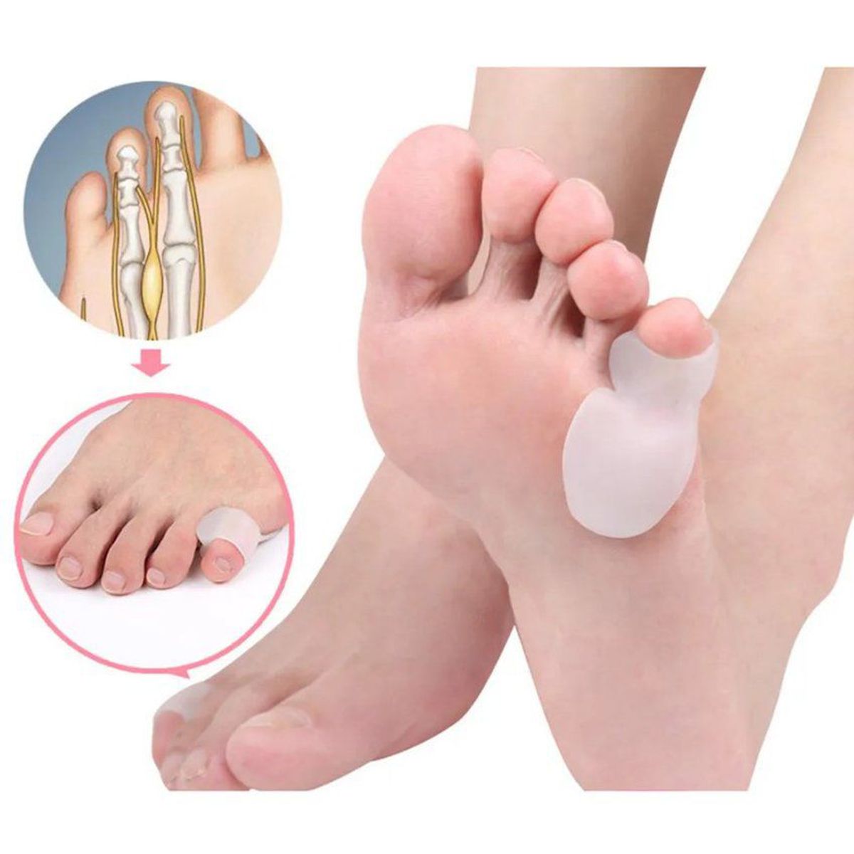 GENERICO - Corrector ortopédico de silicona